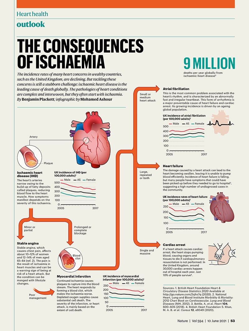 A Graphical Guide to Ischemic Heart Disease Scientific American